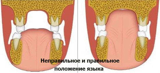 Положение языка в полости рта